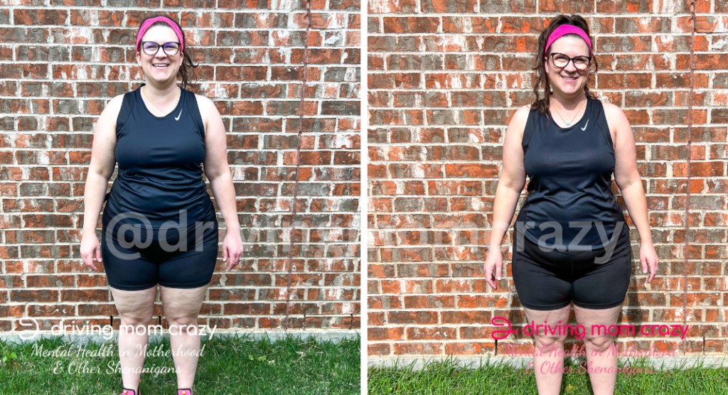 Semaglutide Before and After McKinney TX